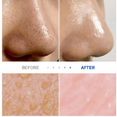 one-days-you P.Z. Ssoc Ssoc No More Blackhead 100ml